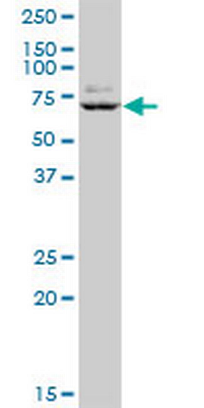 GTF3C5 Antibody in Western Blot (WB)