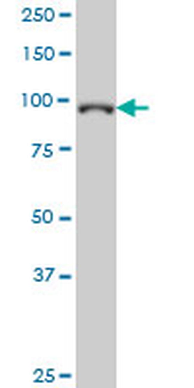 GTF3C3 Antibody in Western Blot (WB)