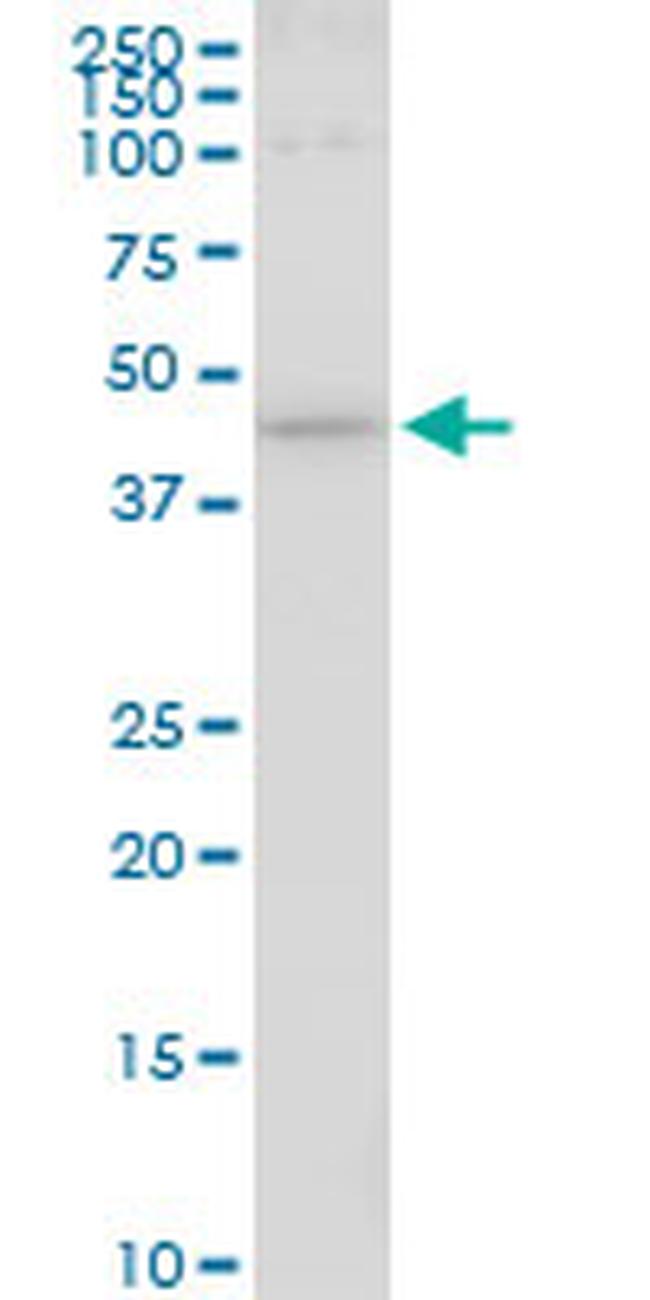 HS6ST1 Antibody in Western Blot (WB)
