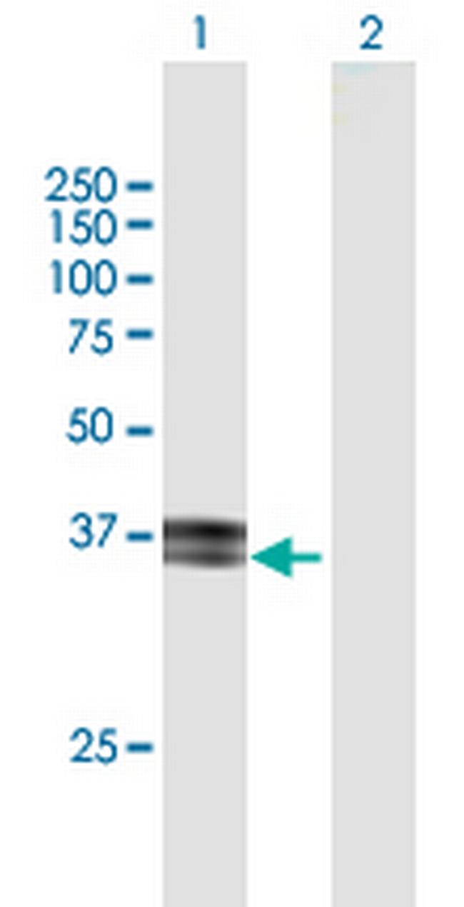 ITM2B Antibody in Western Blot (WB)