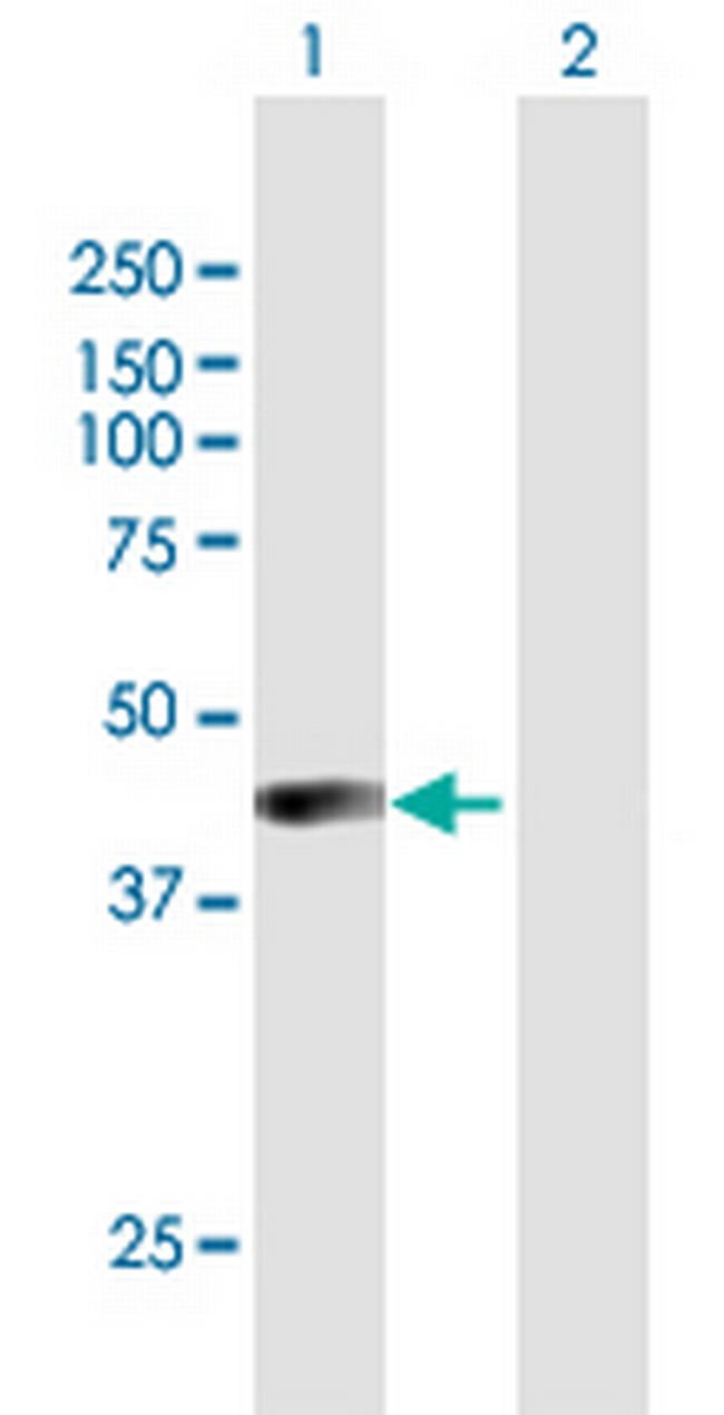 AIM2 Antibody in Western Blot (WB)