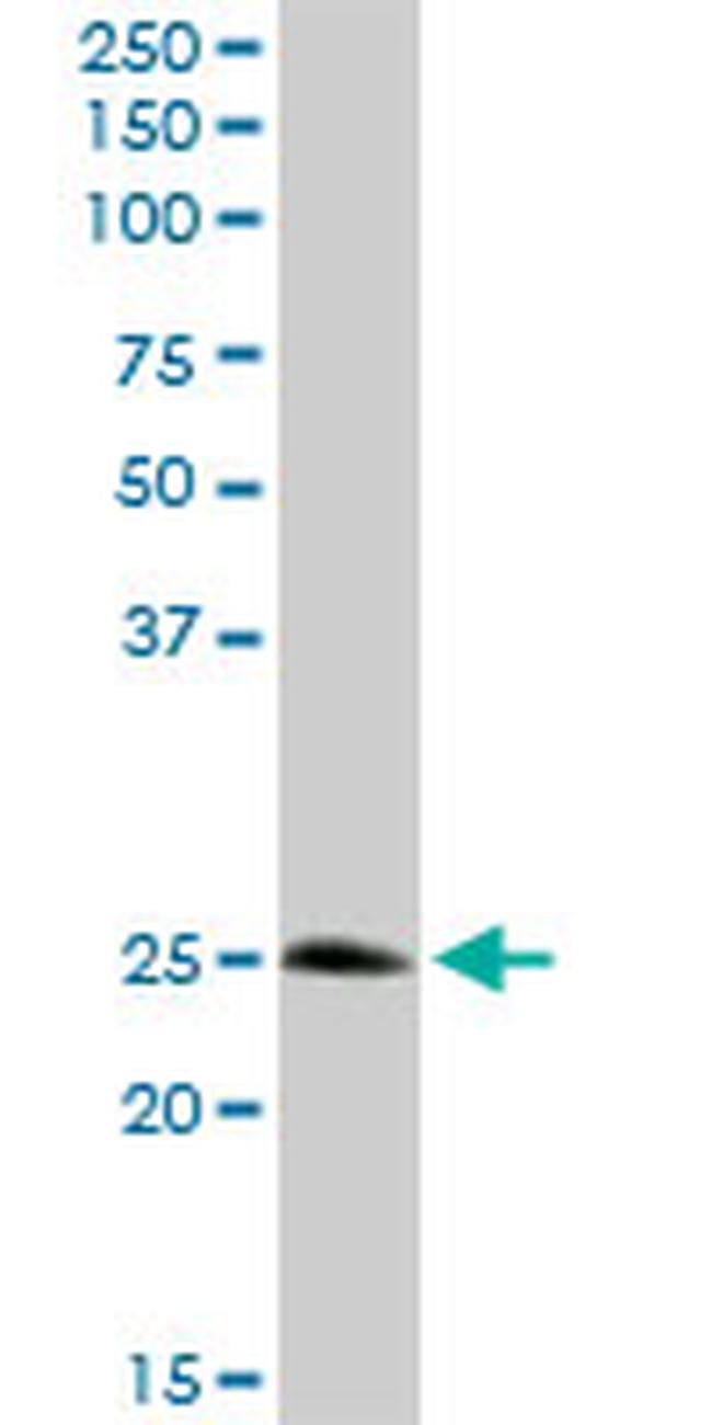 STX8 Antibody in Western Blot (WB)