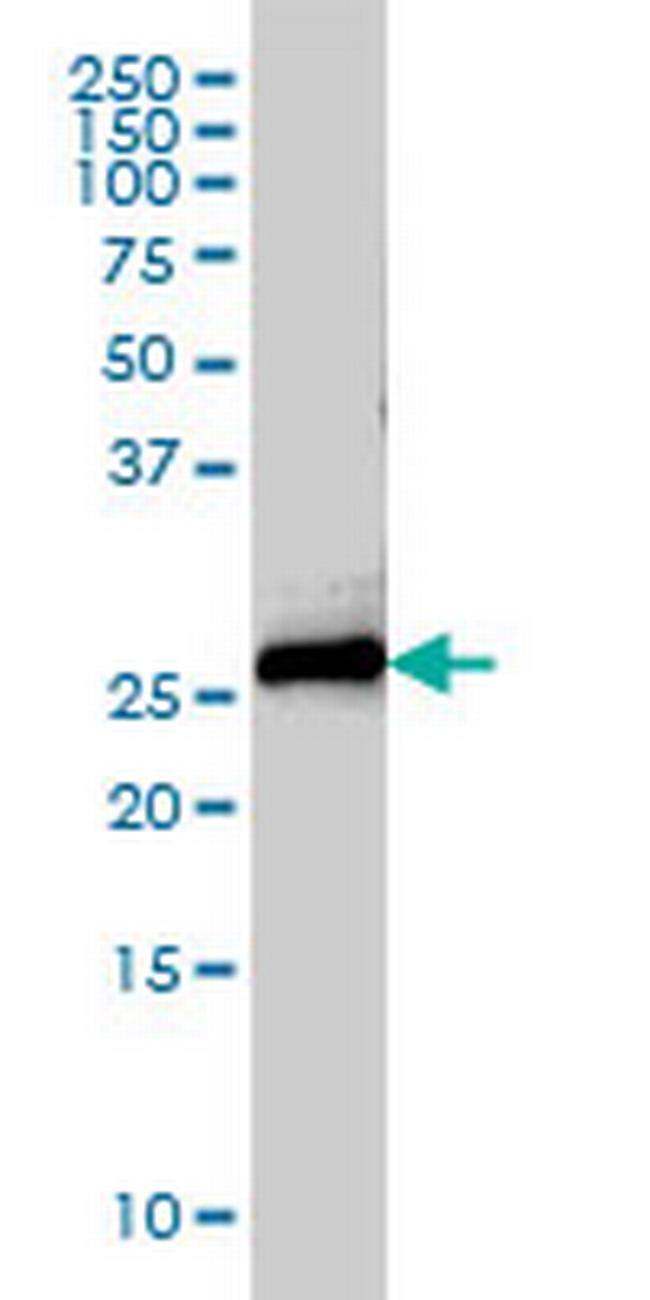 STX8 Antibody in Western Blot (WB)