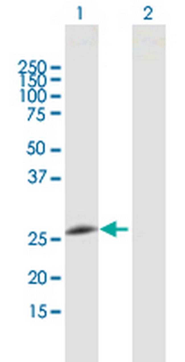 GOSR2 Antibody in Western Blot (WB)