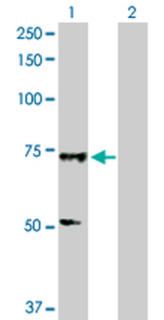 SOX13 Antibody in Western Blot (WB)