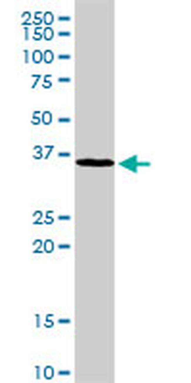 MAD2L1BP Antibody in Western Blot (WB)