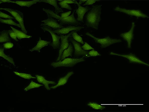 TRAF4 Antibody in Immunocytochemistry (ICC/IF)