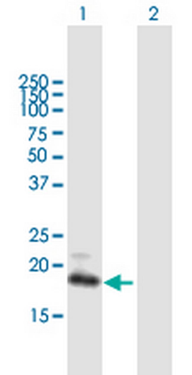 GUCA1C Antibody in Western Blot (WB)