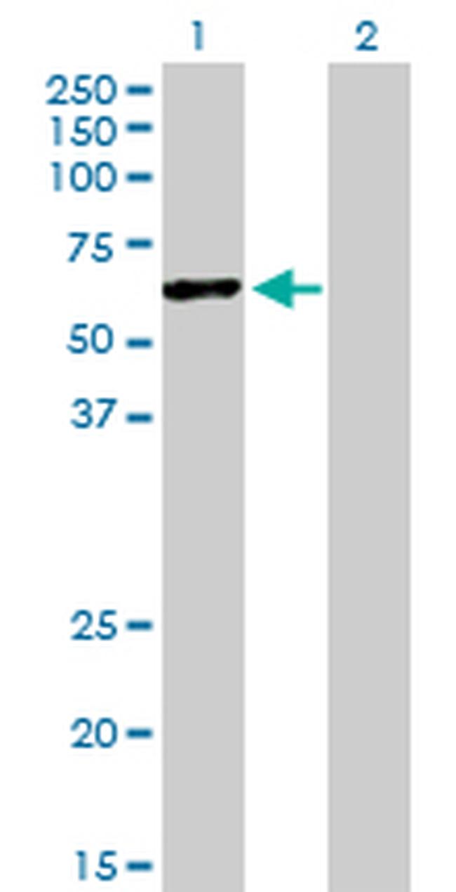 HERPUD1 Antibody in Western Blot (WB)