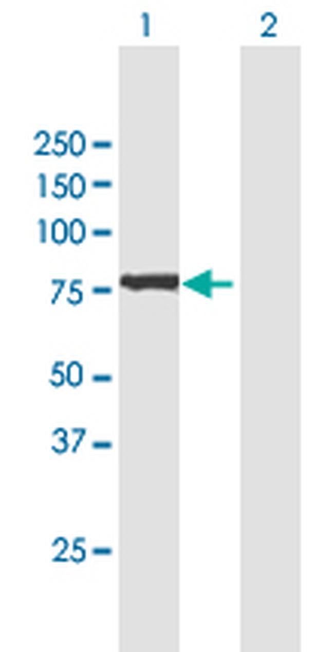 GFPT2 Antibody in Western Blot (WB)