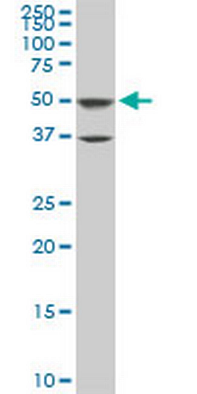 ROD1 Antibody in Western Blot (WB)