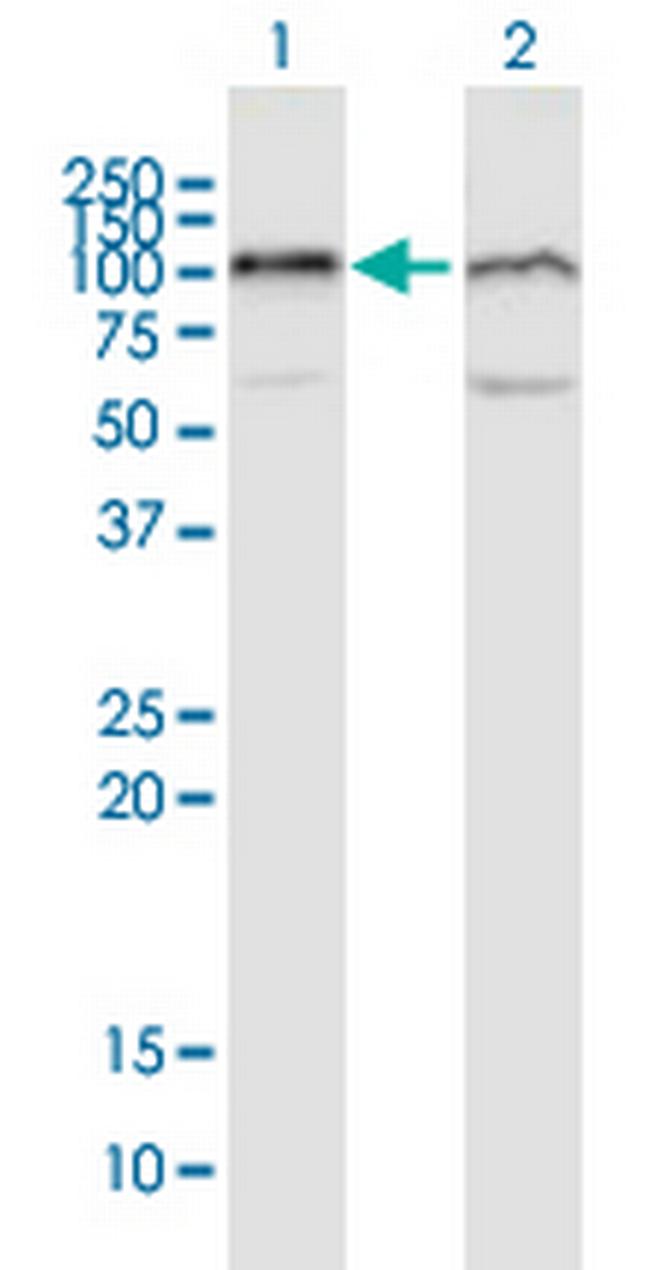 UBA2 Antibody in Western Blot (WB)