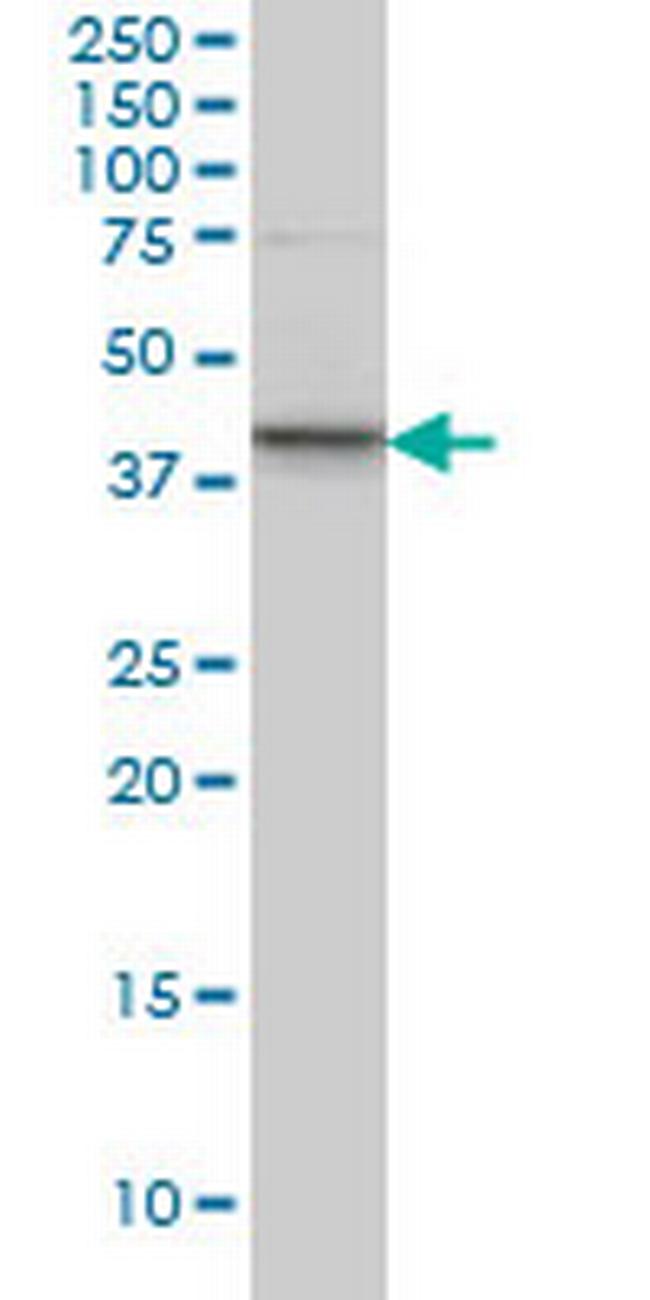 SGK2 Antibody in Western Blot (WB)