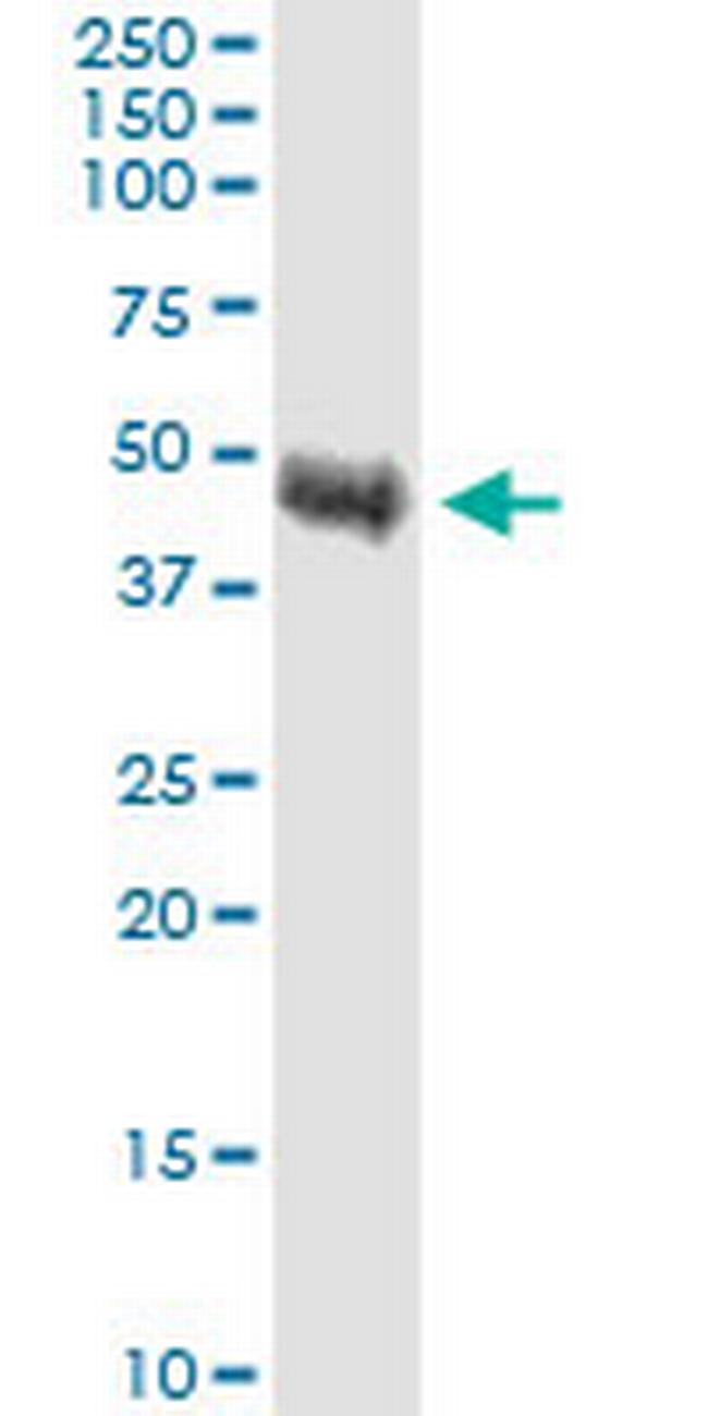 TRIB1 Antibody in Western Blot (WB)