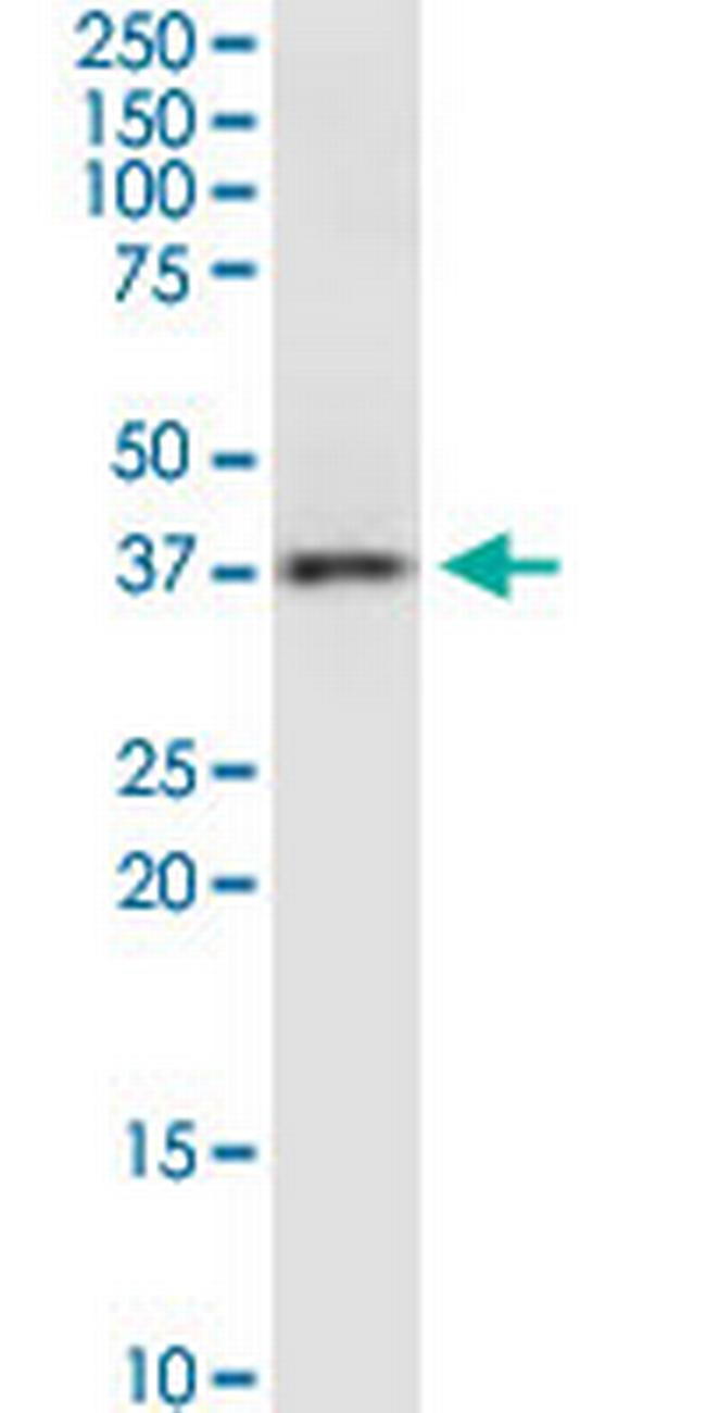 RAMP3 Antibody in Western Blot (WB)