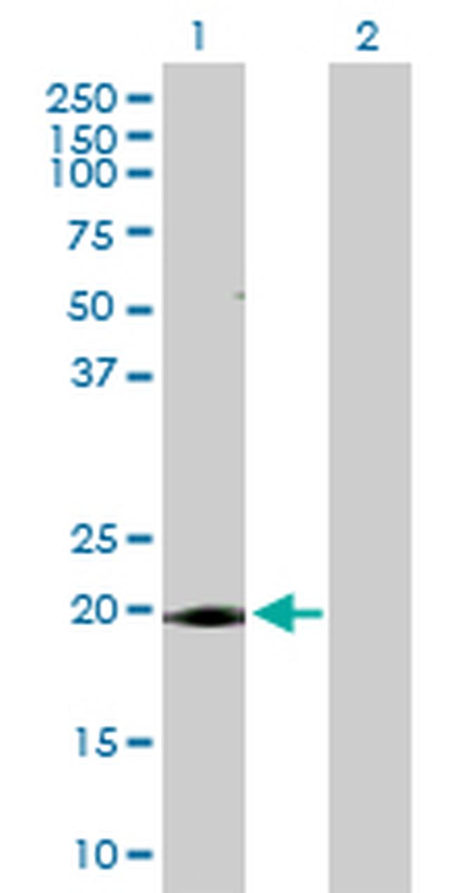 ANAPC10 Antibody in Western Blot (WB)