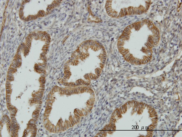 NDRG1 Antibody in Immunohistochemistry (Paraffin) (IHC (P))