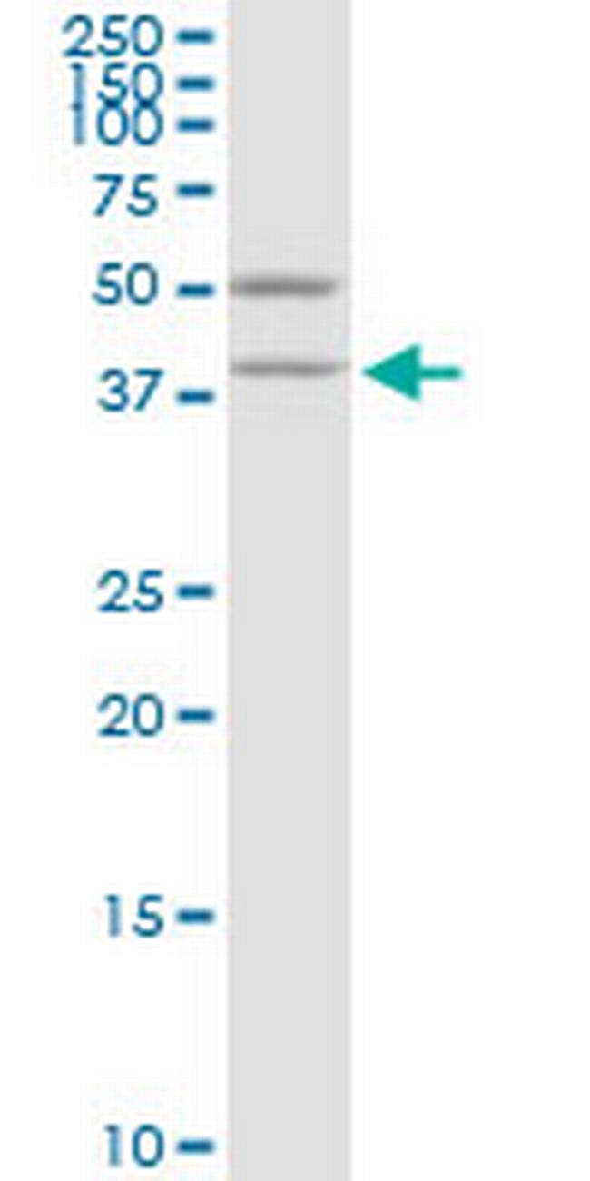 VAT1 Antibody in Western Blot (WB)