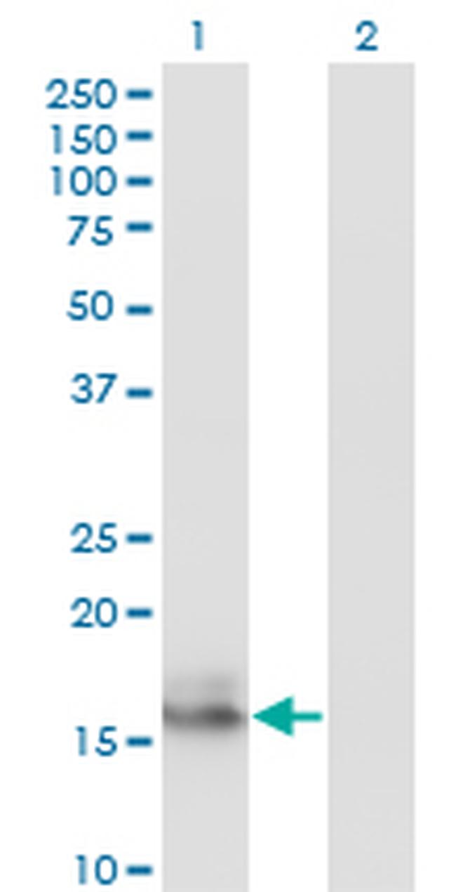 AGR2 Antibody in Western Blot (WB)