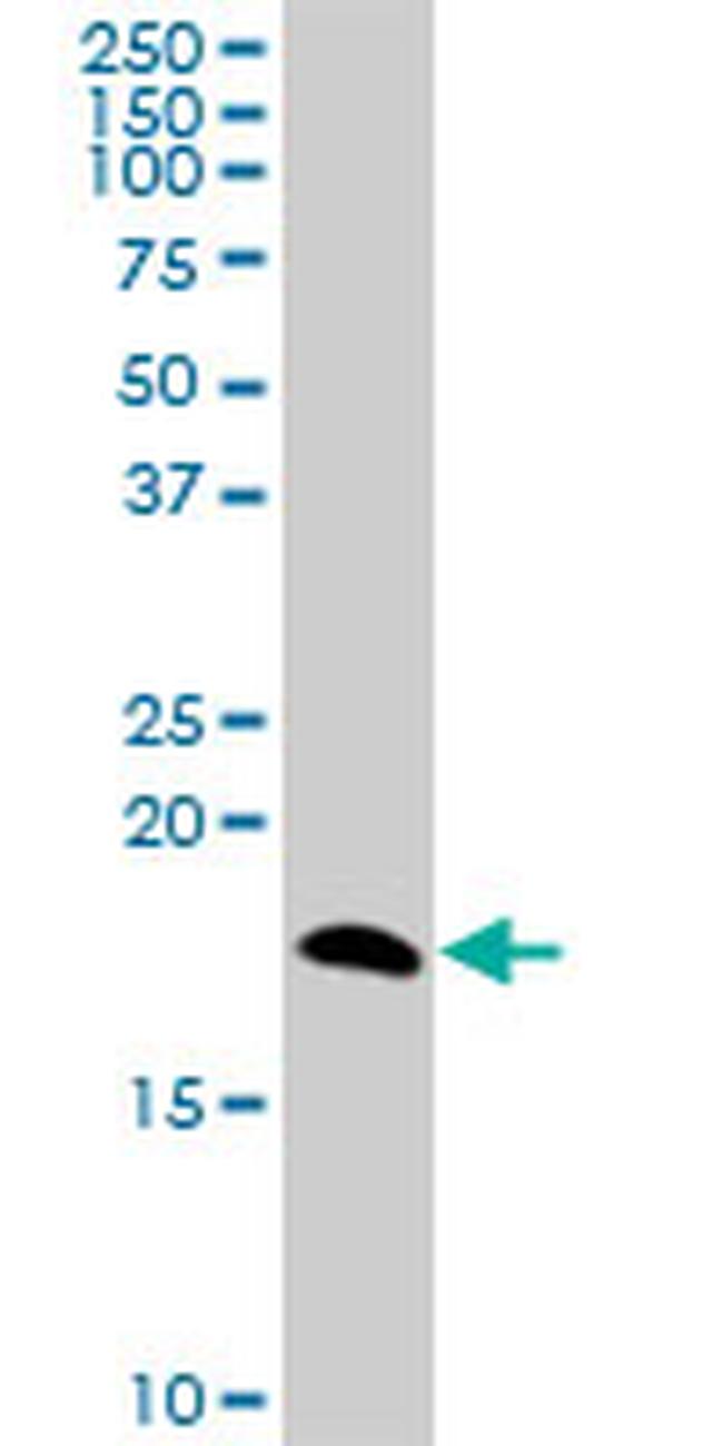 NPC2 Antibody in Western Blot (WB)