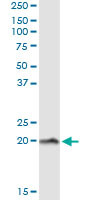 NPC2 Antibody in Immunoprecipitation (IP)