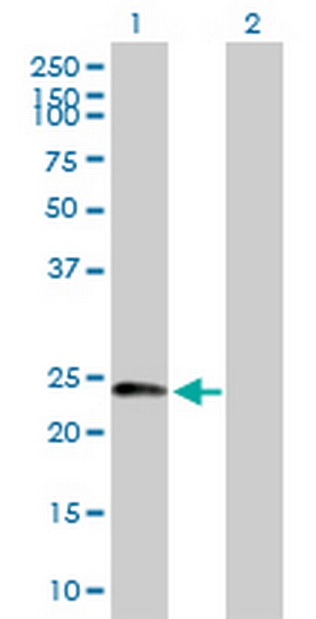 DCTN6 Antibody in Western Blot (WB)