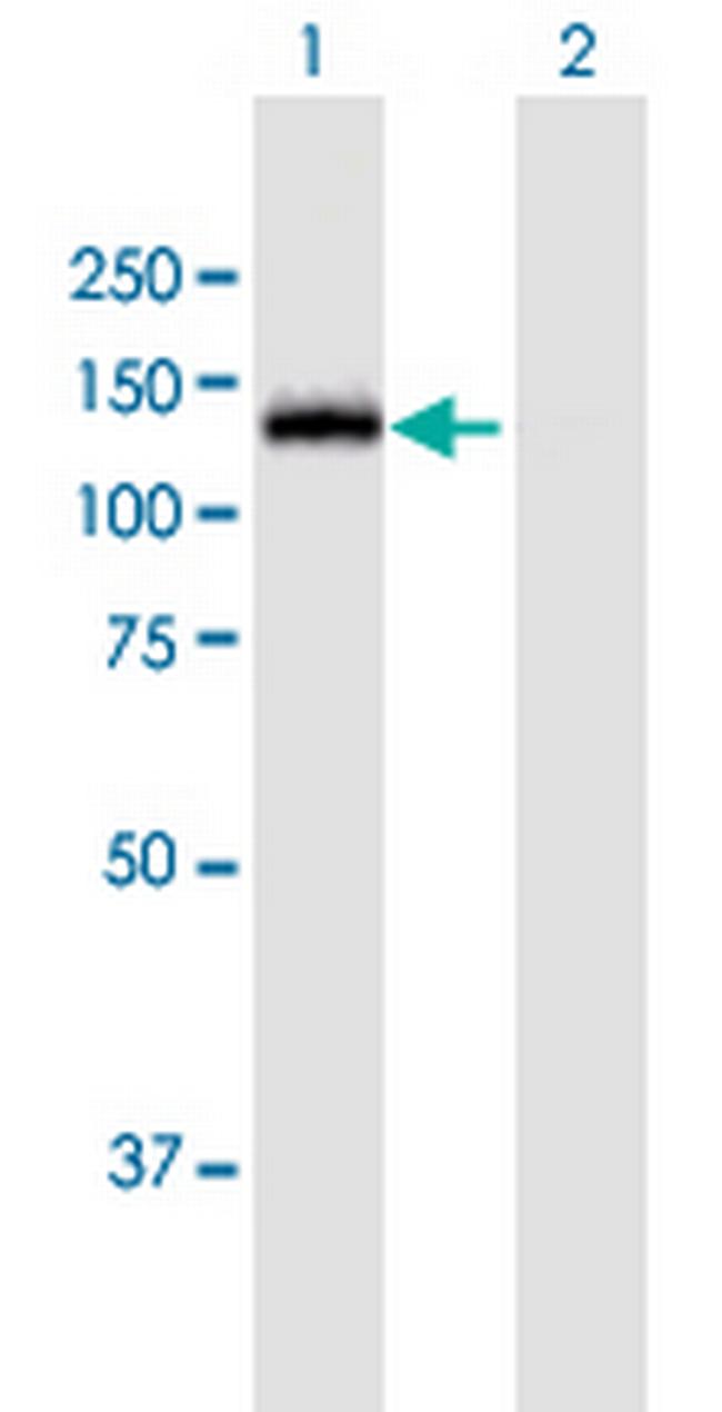 MGEA5 Antibody in Western Blot (WB)