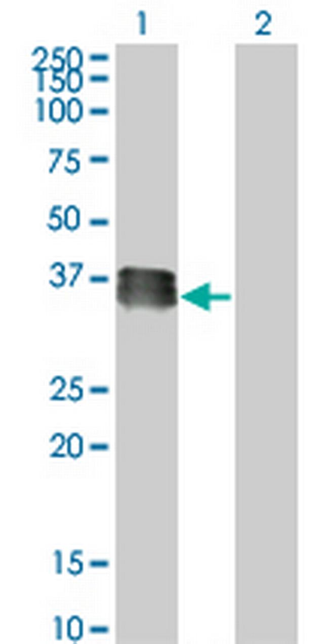 SIX2 Antibody in Western Blot (WB)