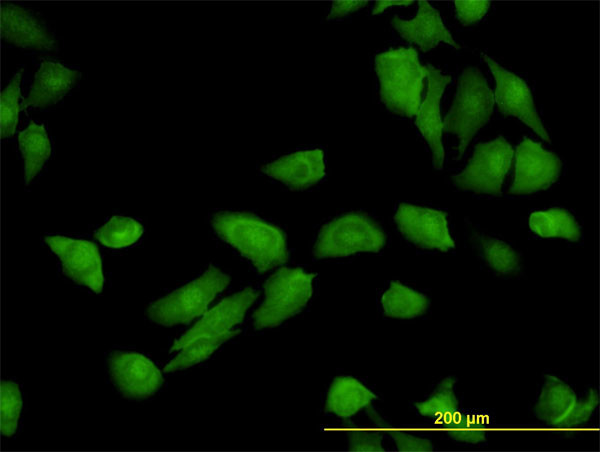 TRAF3IP2 Antibody in Immunocytochemistry (ICC/IF)