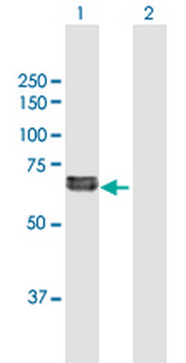 FGL2 Antibody in Western Blot (WB)