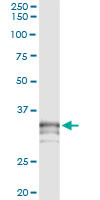 PRSS21 Antibody in Immunoprecipitation (IP)