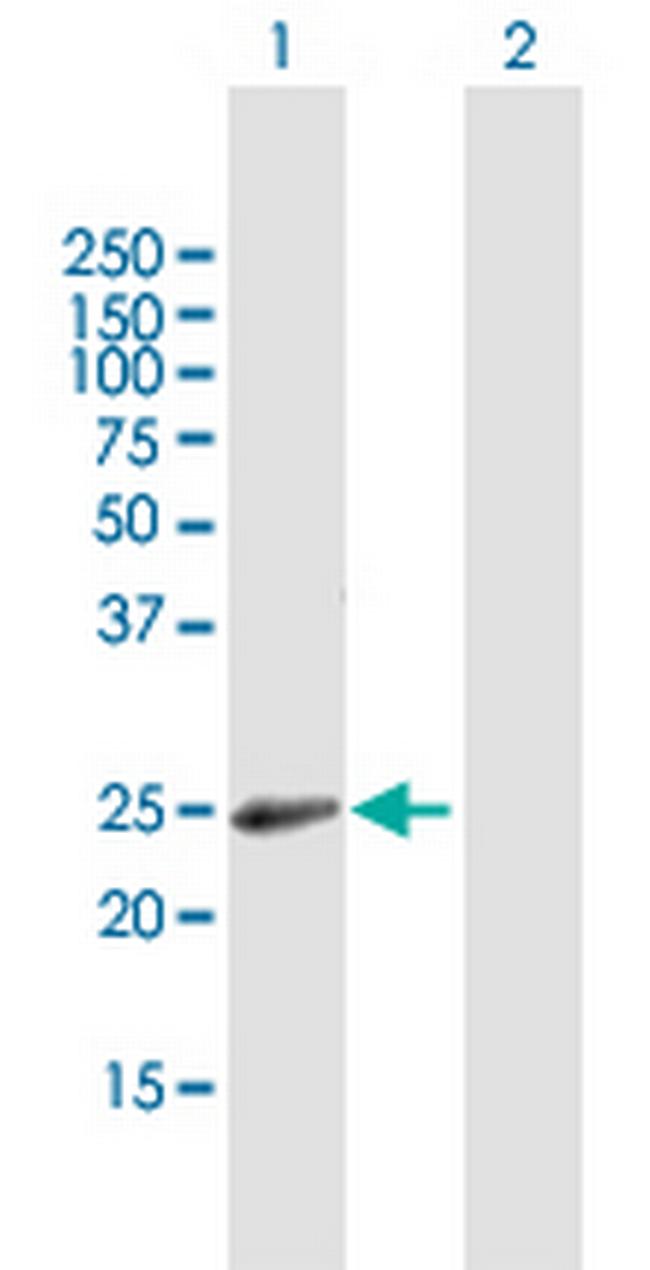 RAB31 Antibody in Western Blot (WB)