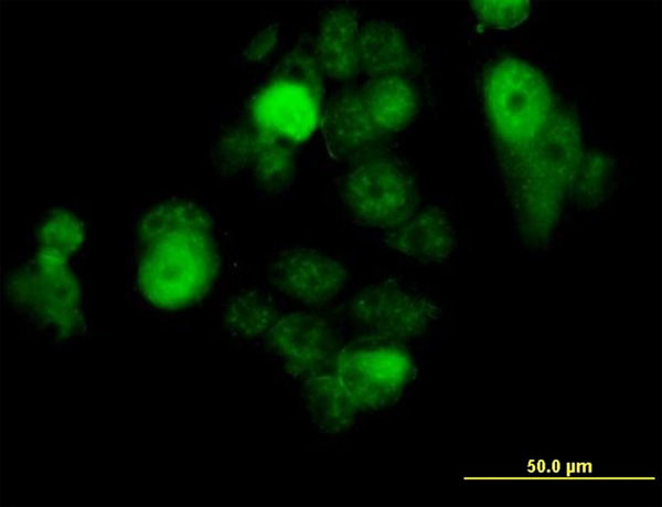 SOX30 Antibody in Immunocytochemistry (ICC/IF)