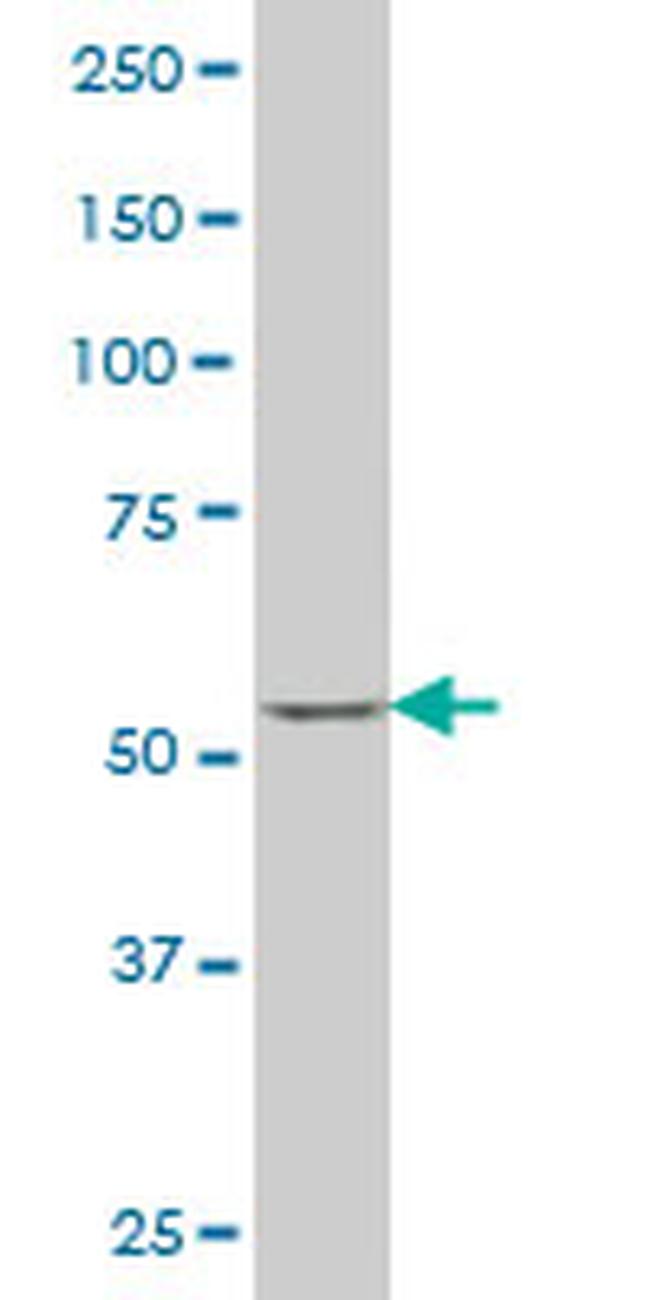 SOX30 Antibody in Western Blot (WB)