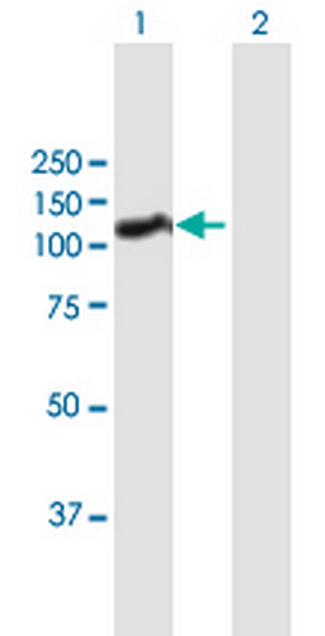 HNRNPUL1 Antibody in Western Blot (WB)