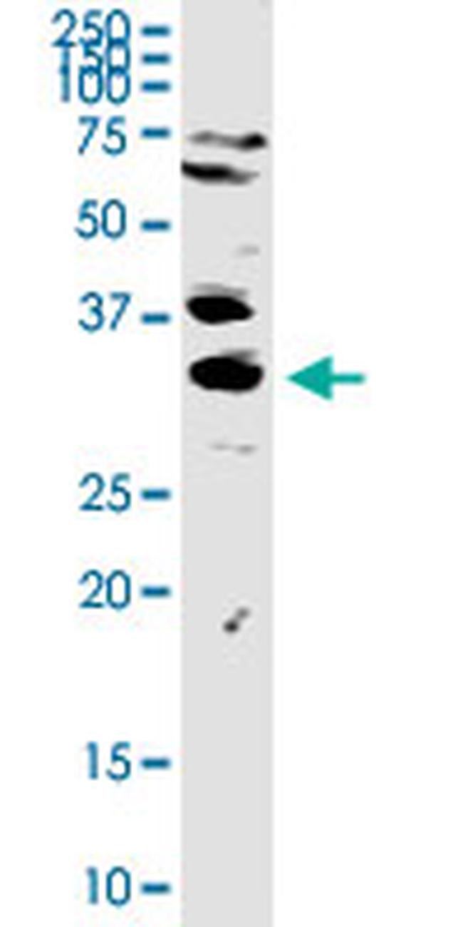 TREX1 Antibody in Western Blot (WB)