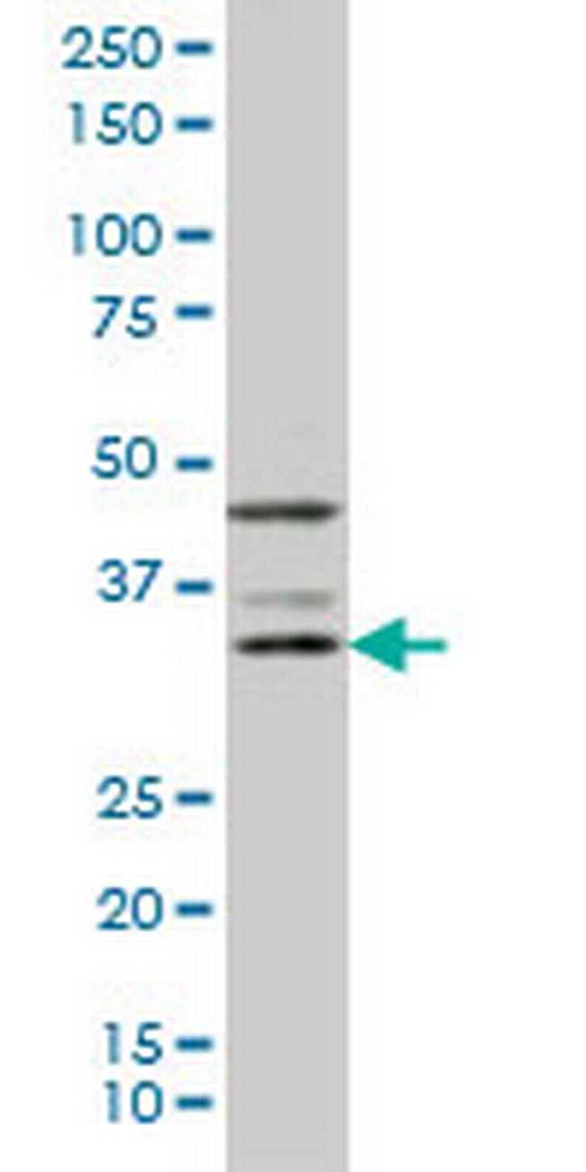 DKK1 Antibody in Western Blot (WB)