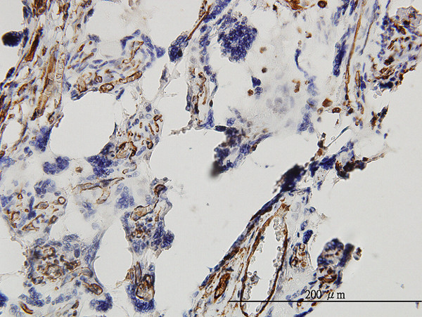 DKK1 Antibody in Immunohistochemistry (Paraffin) (IHC (P))