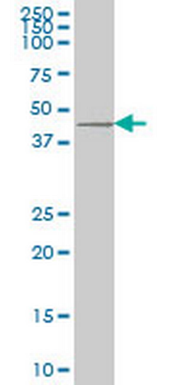 DKK1 Antibody in Western Blot (WB)