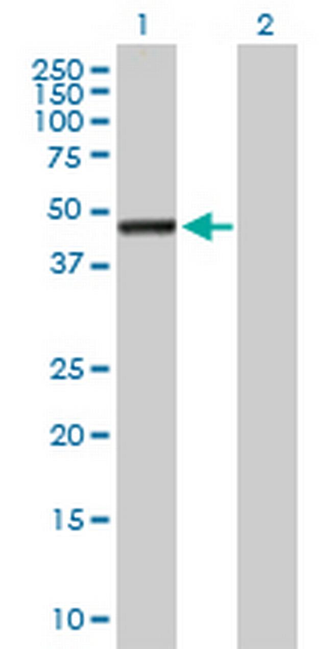 ASTN2 Antibody in Western Blot (WB)