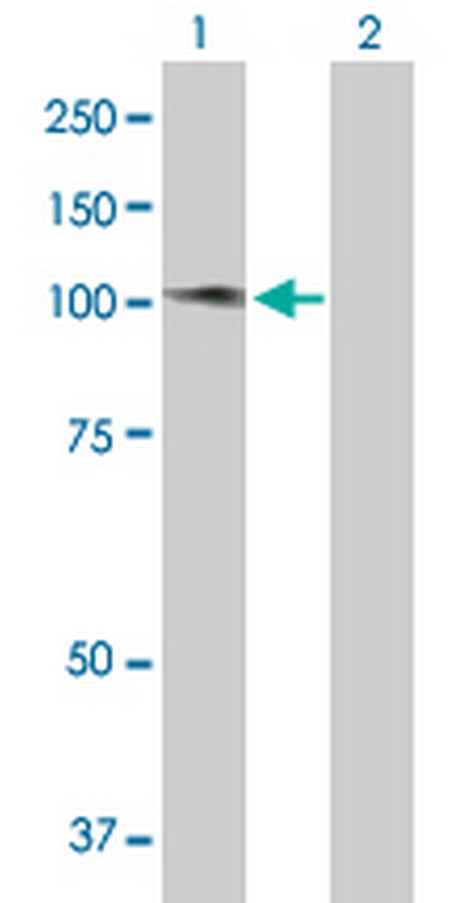 ATMIN Antibody in Western Blot (WB)