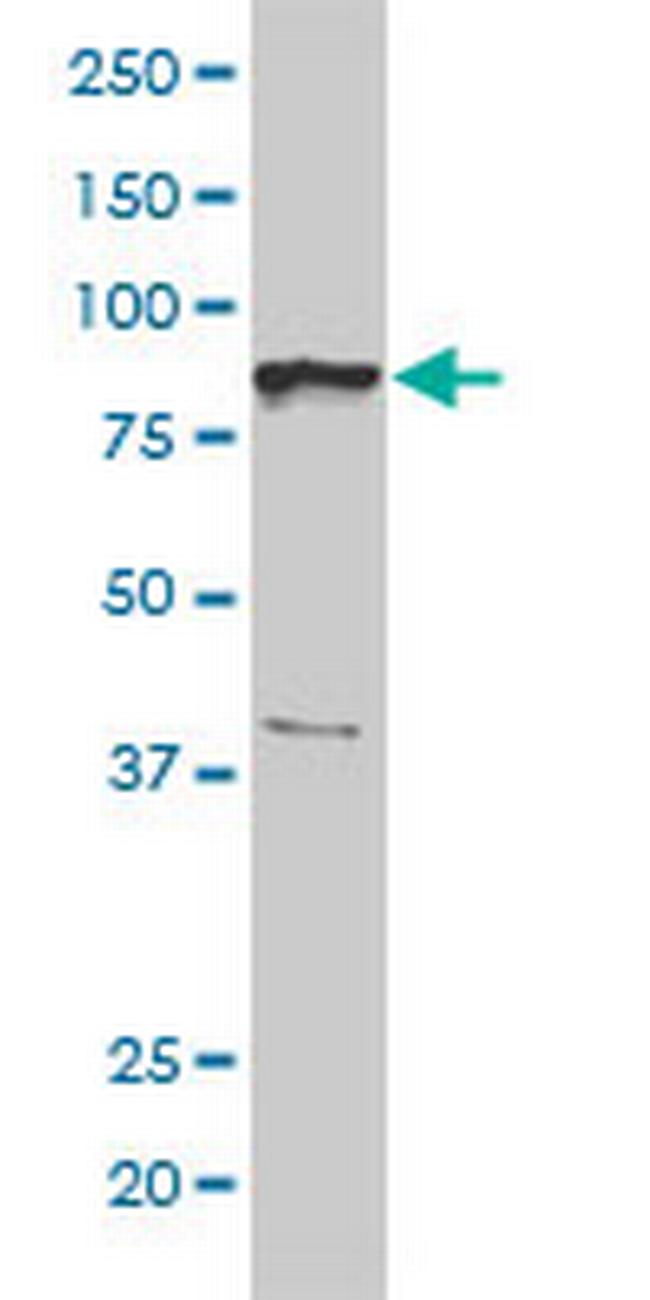 BRRN1 Antibody in Western Blot (WB)