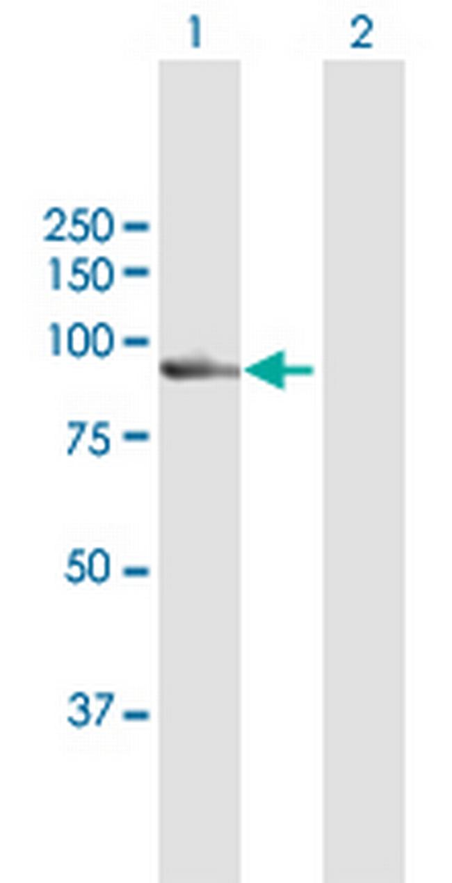 CAPN7 Antibody in Western Blot (WB)