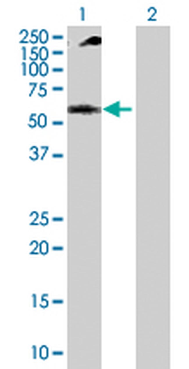 NUP62 Antibody in Western Blot (WB)