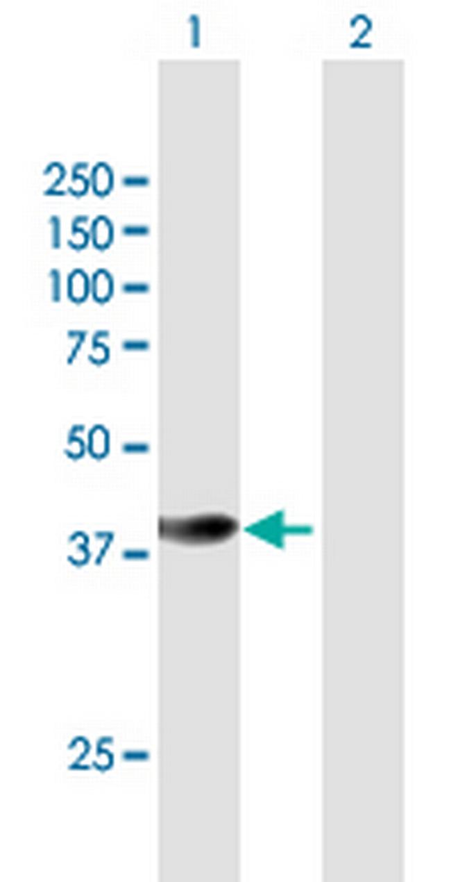 HSPBP1 Antibody in Western Blot (WB)