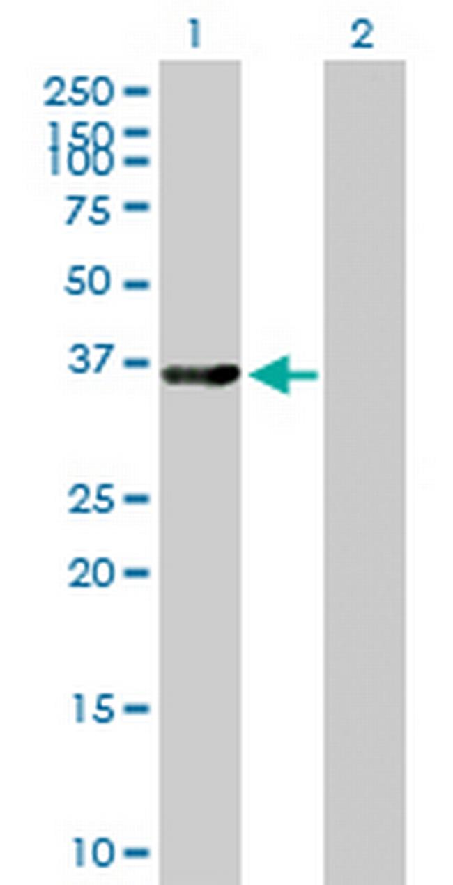 LMOD1 Antibody in Western Blot (WB)