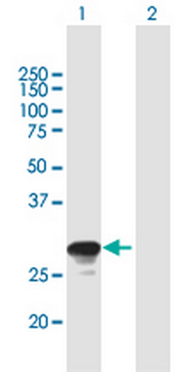 RAB26 Antibody in Western Blot (WB)