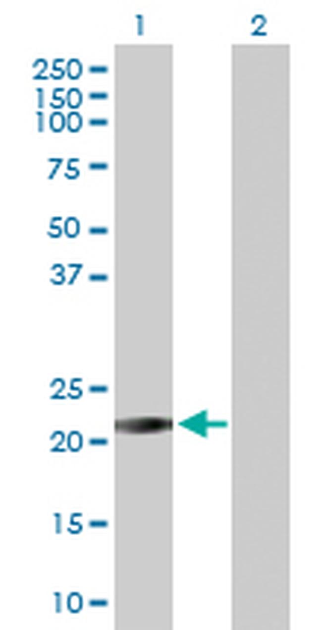 RAB26 Antibody in Western Blot (WB)