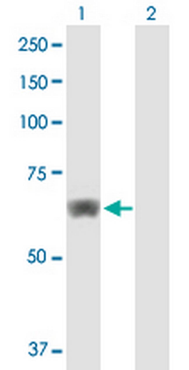 HACL1 Antibody in Western Blot (WB)