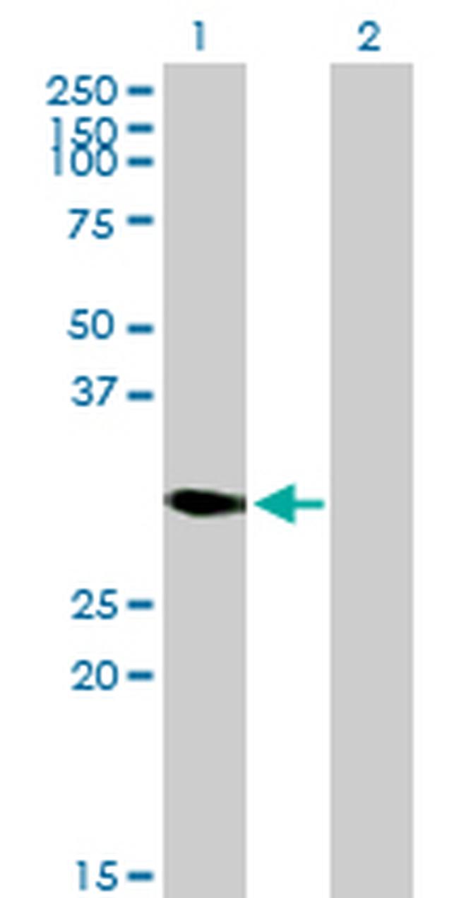 DECR2 Antibody in Western Blot (WB)